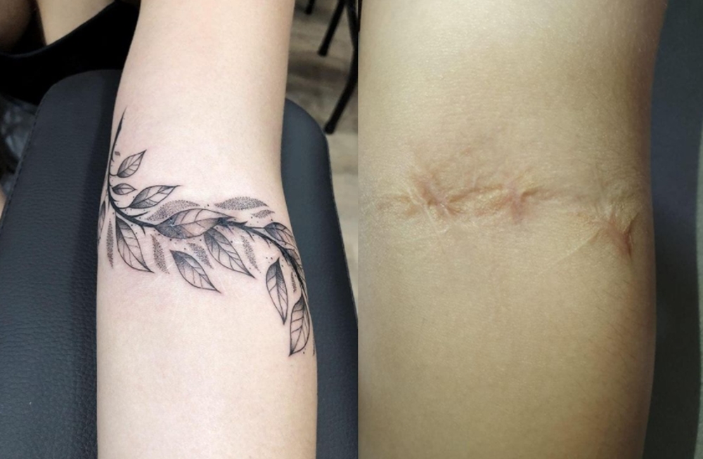 tatuagem para cobrir cicatriz 1