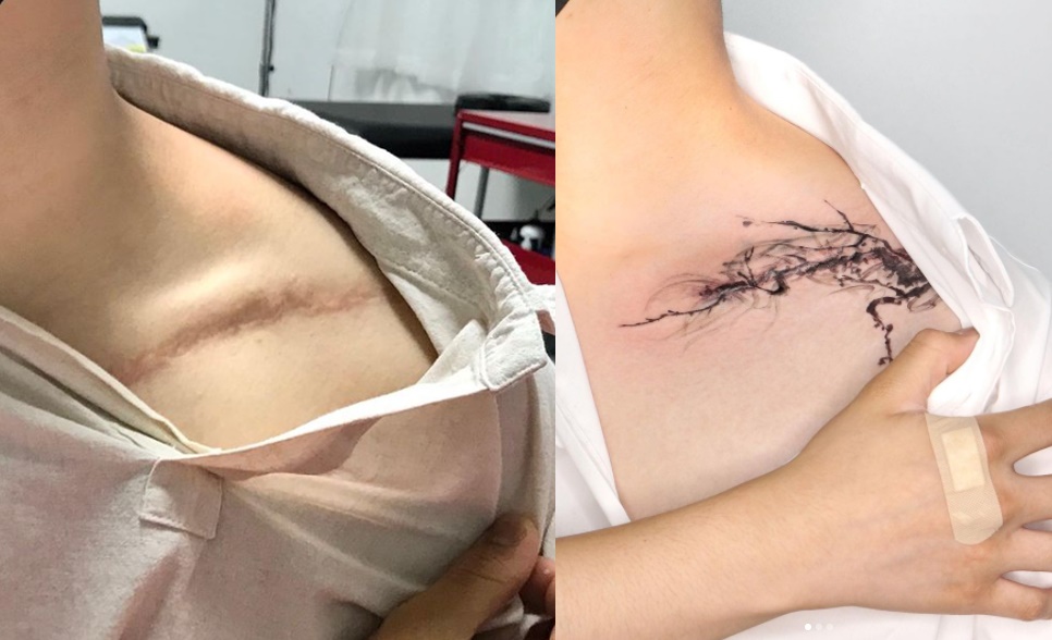 tatuagem para cobrir cicatriz 11