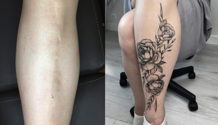 tatuagem para cobrir cicatriz 14