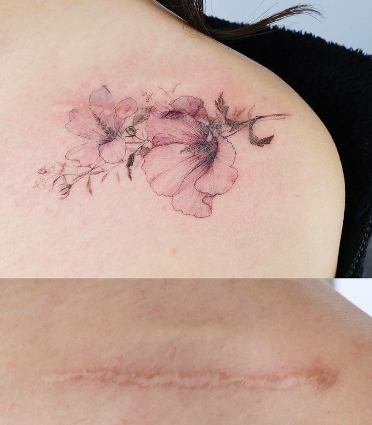 tatuagem para cobrir cicatriz 2