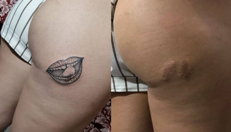 tatuagem para cobrir cicatriz 4