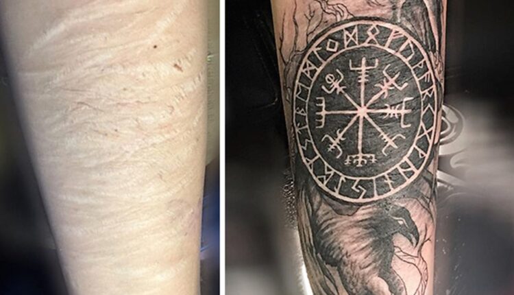 tatuagem para cobrir cicatriz 8